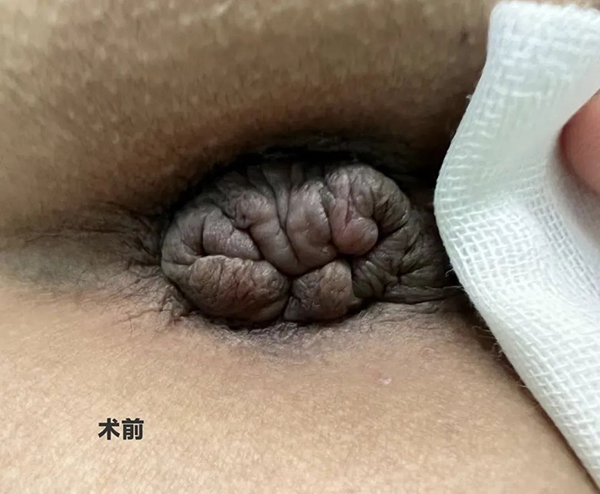 图片35x.jpg